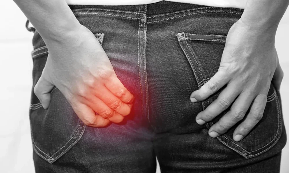 anal-fistül-proktoloji